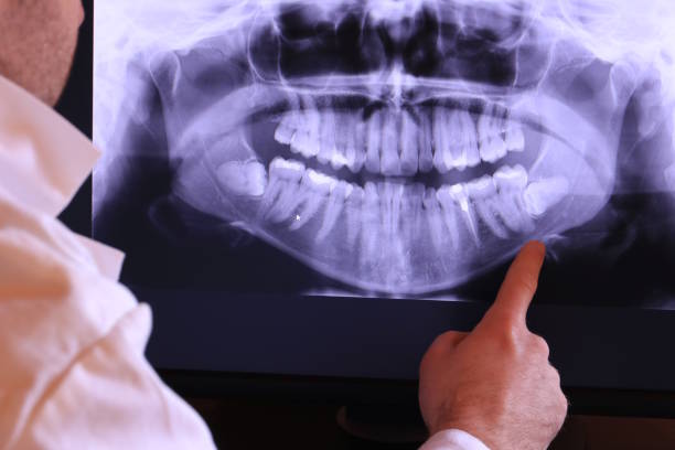 Best Emergency Dentist for Knocked-Out Tooth in Martinez, CA