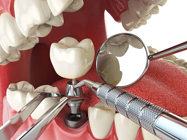 Best Emergency Dentist for Special Needs Patients in Martinez, CA