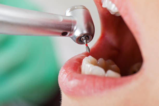 Best Mobile Emergency Dentist in Martinez, CA